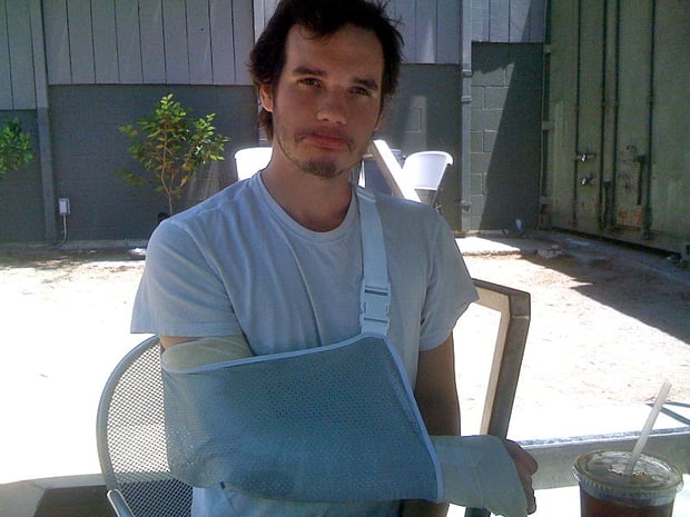 Richards_Broken_Arm-1.jpg